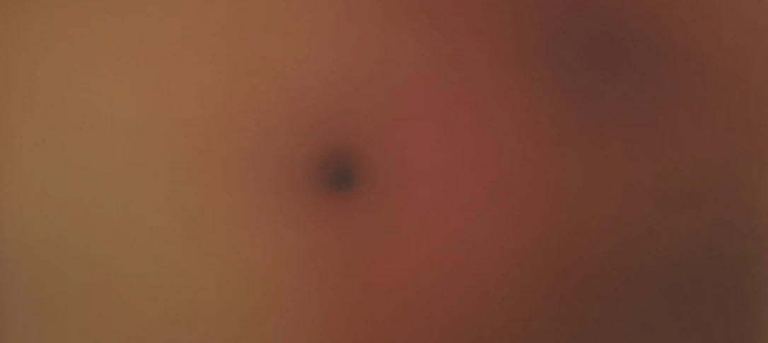 Close-up of a blurred skin surface featuring a small dark mole or blemish, against a warm, soft-toned background.